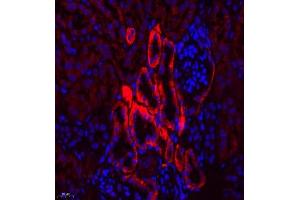 Immunofluorescence of paraffin embedded mouse kidney using SLC7A8 (ABIN7074503) at dilution of 1:300 (400x lens) (LAT2 抗体)