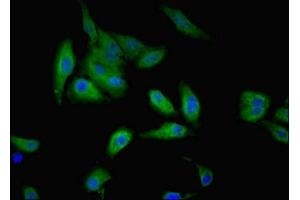 Immunofluorescent analysis of Hela cells using ABIN7174611 at dilution of 1:100 and Alexa Fluor 488-congugated AffiniPure Goat Anti-Rabbit IgG(H+L) (GALE 抗体  (AA 1-348))