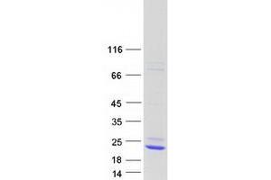 Validation with Western Blot (LCN15 Protein (Myc-DYKDDDDK Tag))