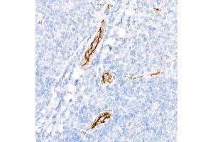 Immunohistochemistry of paraffin-embedded Human tonsil using von Willebrand factor (VWF) antibody (ABIN7271339) at dilution of 1:800 (40x lens). (VWF 抗体)