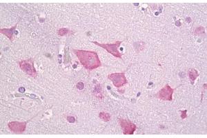 Anti-CSNK1E antibody IHC staining of human brain, cortex neurons. (CK1 epsilon 抗体  (AA 276-325))