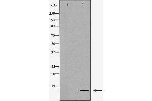 Western blot analysis of Hepg2 whole cell lysates, using SNRPE Antibody. (SNRPE 抗体)