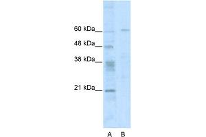 WB Suggested Anti-ZNF192 Antibody Titration:  0. (ZNF192 抗体  (N-Term))