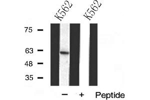 Western blot analysis of DCT(TRP2) expression in K562 cells (DCT 抗体  (N-Term))