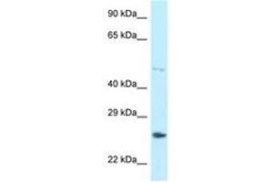 Image no. 1 for anti-Heterogeneous Nuclear Ribonucleoprotein F (HNRNPF) (AA 328-377) antibody (ABIN6747978) (HNRNPF 抗体  (AA 328-377))