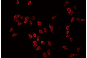 ABIN6266494 staining HeLa by IF/ICC. (MST1R 抗体  (C-Term))