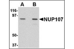 Western blot analysis of NUP107 in A549 cell lysate with this product at (A) 1 and (B) 2 μg/ml.
