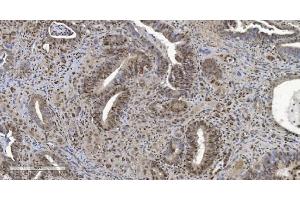 IHC analysis of HP1 alpha/CBX5 using anti-HP1 alpha/CBX5 antibody (ABIN7599057).