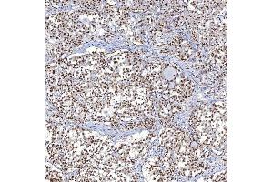 IHC analysis of TRMT61A using anti-TRMT61A antibody (ABIN7599220).
