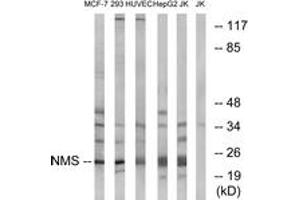 Western Blotting (WB) image for anti-Neuromedin S (NMS) (AA 104-153) antibody (ABIN2890459) (NMS 抗体  (AA 104-153))