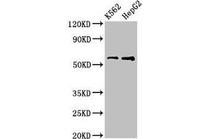 Western Blot Positive WB detected in: K562 whole cell lysate, HepG2 whole cell lysate All lanes: FSCN1 antibody at 3.