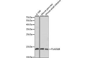 Western blot analysis of extracts of various cell lines, using PLG1B antibody (ABIN6129428, ABIN6145724, ABIN6145725 and ABIN6221143) at 1:1000 dilution. (PLA2G1B 抗体  (AA 23-148))