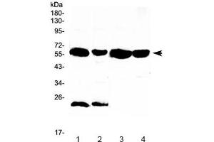 Western blot testing of 1) rat liver, 2) rat kidney, 3) mouse liver and 4) mouse kidney lysate with UGT1A1 antibody at 0. (UGT1A1 抗体)