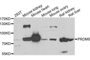 Western blot analysis of extracts of various cell lines, using PRDM5 antibody (ABIN5975510) at 1/1000 dilution. (PRDM5 抗体)