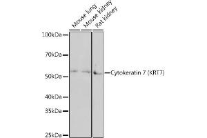 Western blot analysis of extracts of various cell lines, using Cytokeratin 7 (KRT7) (KRT7) Rabbit mAb  at 1:1000 dilution. (Cytokeratin 7 抗体)