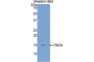 Western blot analysis of the recombinant protein. (INHBC 抗体  (AA 237-352))