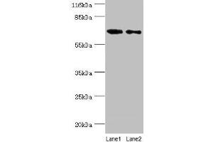 Western blot All lanes: GALNT14 antibody at 2 μg/mL Lane 1: Rat gonad tissue Lane 2: Mouse kidney tissue Secondary Goat polyclonal to rabbit IgG at 1/10000 dilution Predicted band size: 65, 61, 62 kDa Observed band size: 65 kDa (GALNT14 抗体  (AA 1-552))