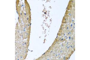 Immunohistochemistry of paraffin-embedded mouse heart using COX5B antibody at dilution of 1:100 (x40 lens). (COX5B 抗体)