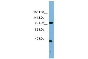 ERCC4 antibody used at 1 ug/ml to detect target protein. (ERCC4 抗体  (Middle Region))