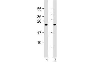 Western blot testing of 1) human skeletal muscle and 2) rat skeletal muscle lysate with MYL1 antibody at 1:2000. (MYL1 抗体  (AA 24-58))