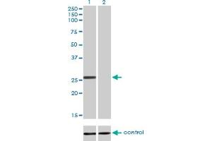 Western blot analysis of BCAS2 over-expressed 293 cell line, cotransfected with BCAS2 Validated Chimera RNAi (Lane 2) or non-transfected control (Lane 1). (BCAS2 抗体  (AA 116-225))