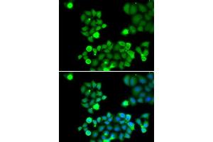Immunofluorescence analysis of HeLa cells using NEIL1 antibody (ABIN5973442). (NEIL1 抗体)