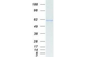 Validation with Western Blot