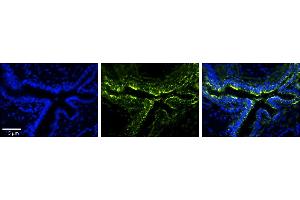 Rabbit Anti-PLOD2 Antibody     Formalin Fixed Paraffin Embedded Tissue: Human Bronchial Epithelial Tissue  Observed Staining: Cytoplasmic  Primary Antibody Concentration: 1:100  Secondary Antibody: Donkey anti-Rabbit-Cy3  Secondary Antibody Concentration: 1:200  Magnification: 20X  Exposure Time: 0. (PLOD2 抗体  (Middle Region))