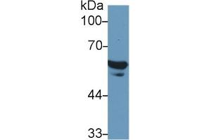 Detection of FGB in Human Serum using Polyclonal Antibody to Fibrinogen Beta Chain (FGB) (Fibrinogen beta Chain 抗体  (AA 29-118))