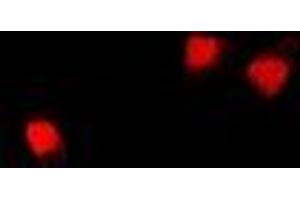 Immunofluorescent analysis of U2AF65 staining in U2OS cells. (U2AF2 抗体)