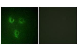 Immunofluorescence analysis of HUVEC cells, using TMEPA antibody. (PMEPA1 抗体  (Internal Region))