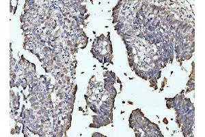 IHC analysis of RRP4/EXOSC2 using anti-RRP4/EXOSC2 antibody (ABIN7602188). (EXOSC2 抗体  (AA 62-293))