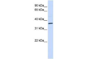 CCR5 antibody used at 5 ug/ml to detect target protein. (CCR5 抗体  (Middle Region))