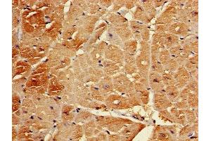 Immunohistochemistry of paraffin-embedded human heart tissue using ABIN7145367 at dilution of 1:100 (B3GALT2 抗体  (AA 201-422))