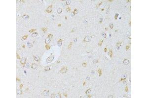 Immunohistochemistry of paraffin-embedded Rat brain using NTS Polyclonal Antibody at dilution of 1:100 (40x lens). (Neurotensin 抗体)