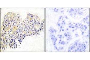Immunohistochemistry (IHC) image for anti-Heat Shock Protein 90kDa alpha (Cytosolic), Class B Member 1 (HSP90AB1) (AA 226-275) antibody (ABIN1532199)