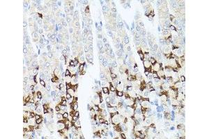 Immunohistochemistry of paraffin-embedded Mouse stomach using GPM6A Polyclonal Antibody at dilution of 1:100 (40x lens). (GPM6A 抗体)