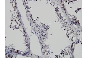 Immunoperoxidase of monoclonal antibody to SMNDC1 on formalin-fixed paraffin-embedded human testis. (SMNDC1 抗体  (AA 1-238))