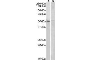 ABIN184642 (2µg/ml) staining of Human Bone Marrow (A) and PBL (B) lysates (35µg protein in RIPA buffer). (DOK3 抗体  (C-Term))