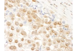 Immunohistochemistry (IHC) image for anti-N(alpha)-Acetyltransferase 15, NatA Auxiliary Subunit (NAA15) (AA 816-866) antibody (ABIN7448680)