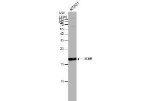 Western Blotting (WB) image for anti-Superoxide Dismutase 1, Soluble (SOD1) antibody (ABIN2854793)