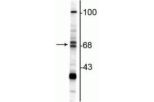 Western blot of rat hippocampal lysate showing specific immunolabeling of the ~68/70 kDa ChAT. (Choline Acetyltransferase 抗体)