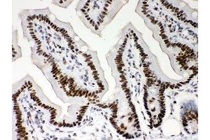 IHC-P: Nucleophosmin antibody testing of mouse intestine tissue (NPM1 抗体  (AA 1-294))