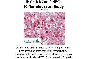 Image no. 2 for anti-NDC80 Kinetochore Complex Component Homolog (NDC80) (C-Term) antibody (ABIN1737233) (NDC80 抗体  (C-Term))