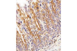 Immunohistochemistry (Paraffin-embedded Sections) (IHC (p)) image for anti-Cytochrome C1 (CYC1) (AA 142-176) antibody (ABIN1944852)