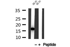 Western blot analysis of extracts of HEK-293 cells, using IFT20 antibody. (IFT20 抗体)