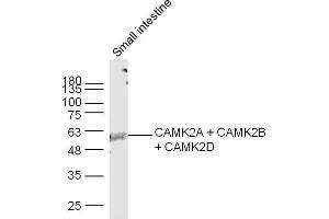 Image no. 5 for anti-Calcium/calmodulin-Dependent Protein Kinase II beta (CAMK2B) (AA 1-100) antibody (ABIN669876)