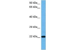 Host:  Mouse  Target Name:  TNNI3  Sample Tissue:  Mouse Pancreas  Antibody Dilution:  1ug/ml (TNNI3 抗体  (Middle Region))