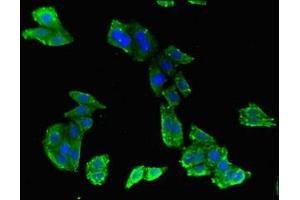anti-ATP-Binding Cassette, Sub-Family B (MDR/TAP), Member 9 (ABCB9) (AA 630-766) antibody
