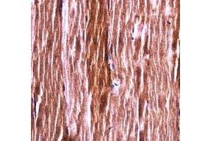 Akt2 antibody immunohistochemistry analysis in formalin fixed and paraffin embedded mouse skeletal muscle. (AKT2 抗体  (AA 93-122))